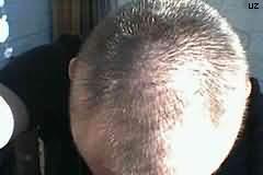 oben
